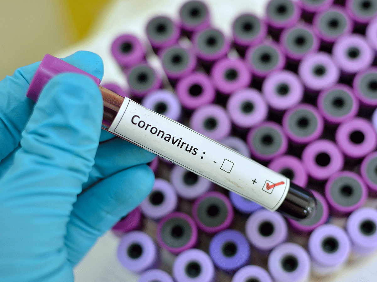 Sveikatos apsaugos ministerija (SAM) praneša, kad kovo 17 d. laboratoriniais tyrimais patvirtinti dar trys nauji koronaviruso infekcijos (COVID-19) atvejai. Iš viso šiuo metu patvirtintų atvejų – 21.