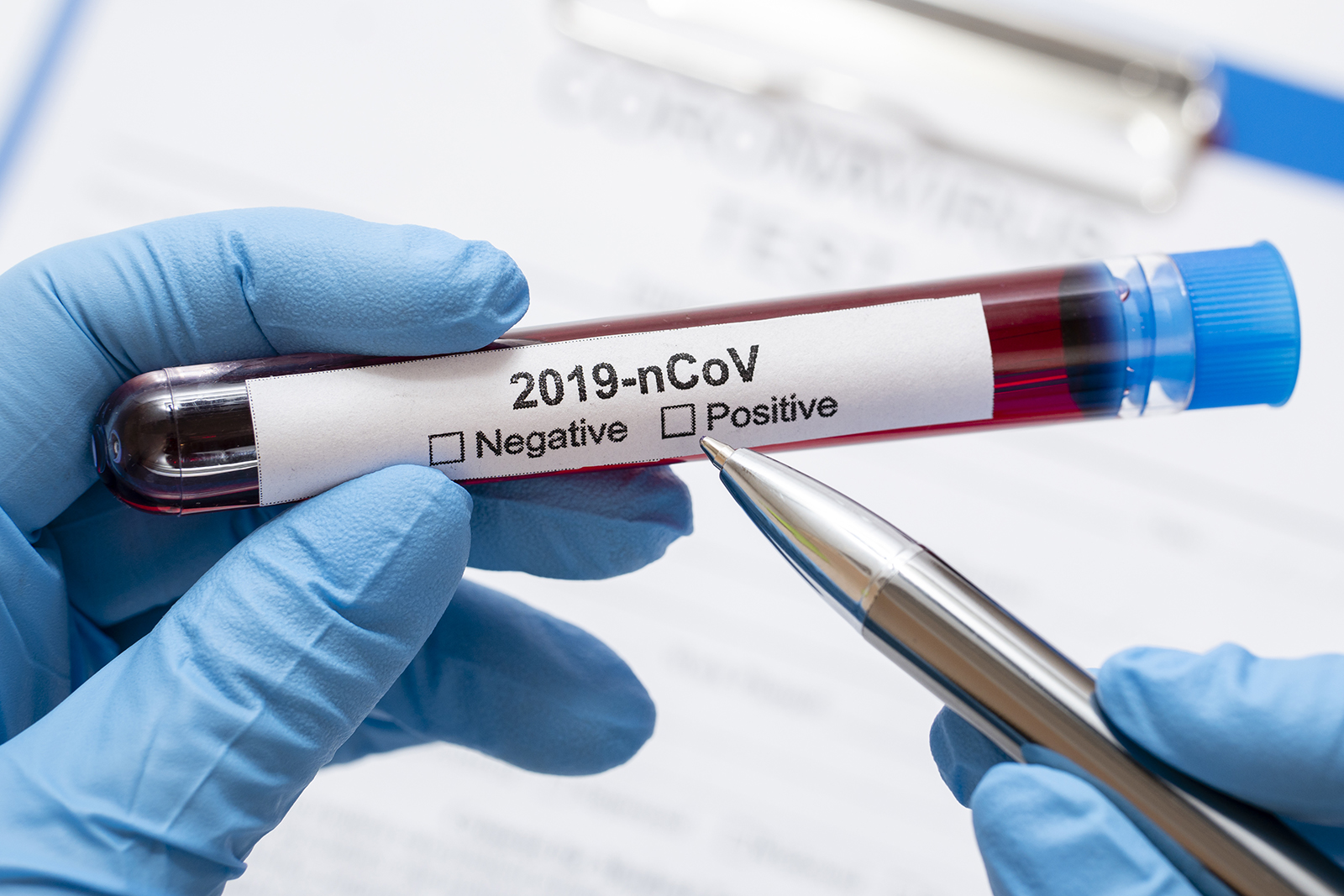Antradienį nustatyti du nauji koronaviruso atvejai – įvežtiniai, pranešė sveikatos apsaugos ministras Aurelijus Veryga.