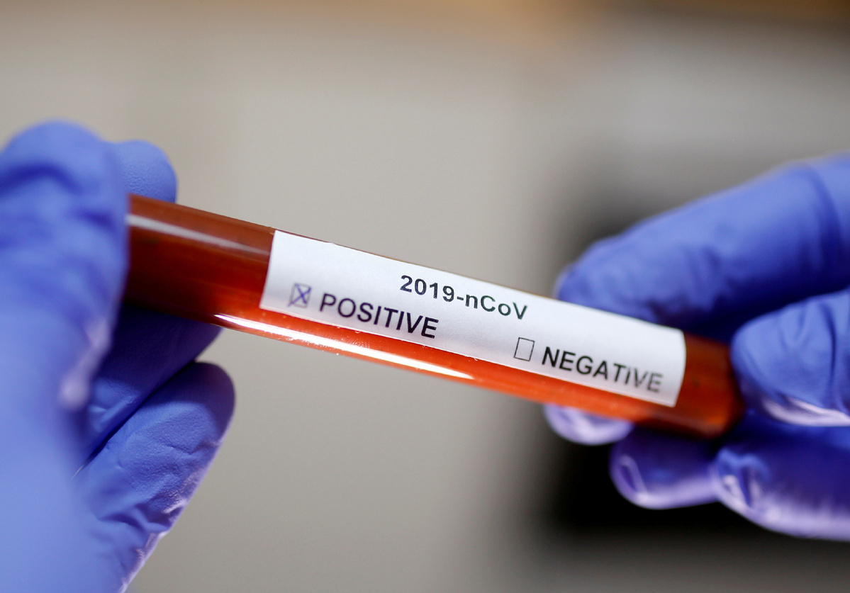 Norintiems išsitirti dėl koronaviruso, testus atlikti galima ir mokamai privačiose laboratorijose – tą daryti leista nuo gegužės pradžios, BNS patvirtino Sveikatos apsaugos ministerija.