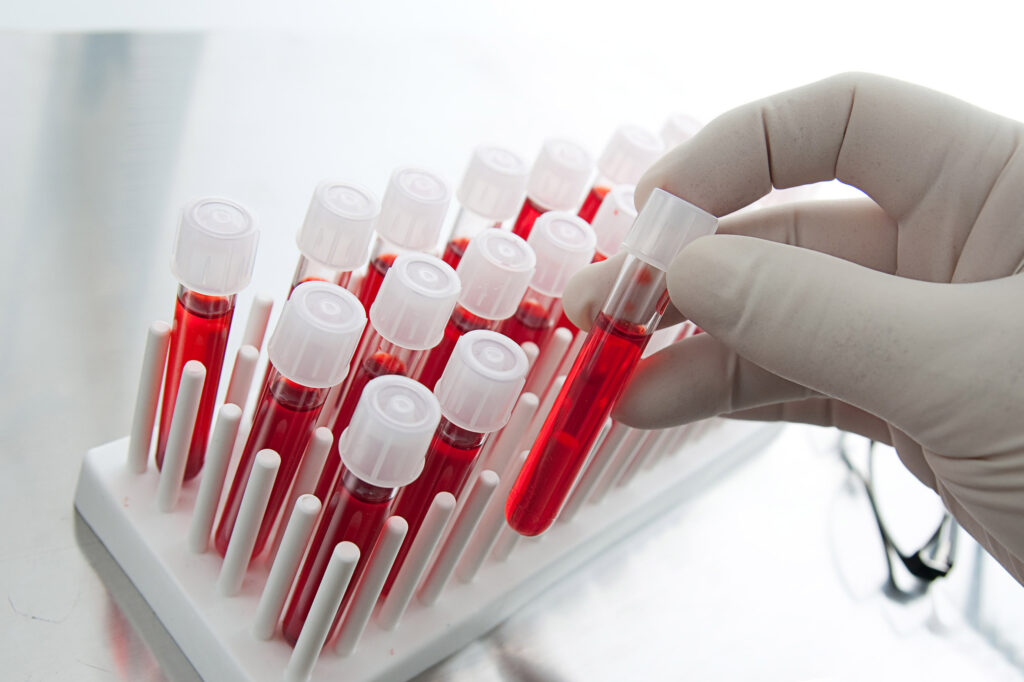 Užkrečiamųjų ligų ir AIDS centro (ULAC) duomenims, pernai savo noru dėl žmogaus imunodeficito viruso (ŽIV) infekcijos pasitikrino beveik 14,5 tūkstančio gyventojų ir tai dvigubai daugiau nei prieš penkerius metus (2012 m.).