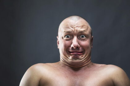 Kai kurie vyrai nuplikti rizikuoja labiau nei kiti stipriosios lyties atstovai.