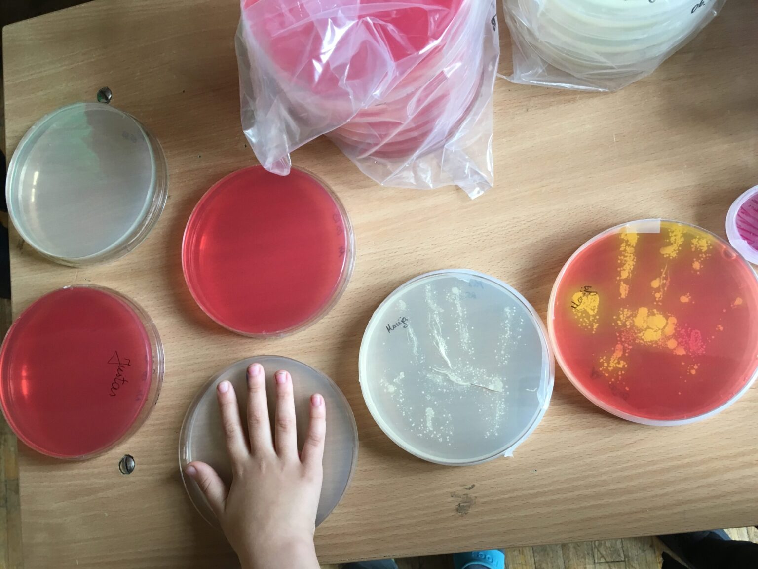 Net 80 proc. infekcinių ligų plinta per nešvarias rankas. Šis faktas atrodo dar baisiau pagalvojus, jog dažnai net nesuprantame, kada būtina rankas plauti.