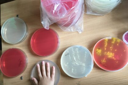 Net 80 proc. infekcinių ligų plinta per nešvarias rankas. Šis faktas atrodo dar baisiau pagalvojus, jog dažnai net nesuprantame, kada būtina rankas plauti.