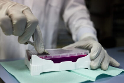 Sveikatos apsaugos ministerija penktadienį planuoja pasirašyti sutartį su viena iš Lietuvoje veikiančių įmonių, jog ši gamintų ir tiektų reikalingus testus koronavirusui nustatyti.