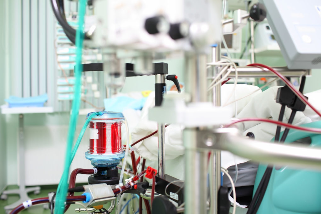 Plaučių ventiliacijos aparatams įsigyti Vyriausybė planuoja skirti 14 mln. eurų.