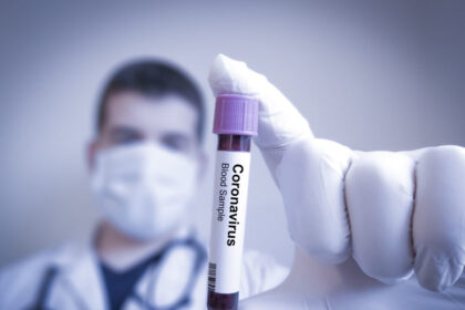 Beveik pusė iš 51 naujo per pastarąją parą registruoto atvejo išaiškinti Vilniaus apskrityje, plečiasi židinys, susijęs su Raseinių policija, pranešė Nacionalinis visuomenės sveikatos centras (NVSC).