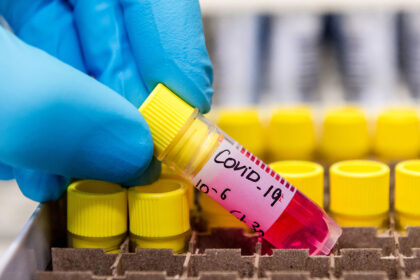 Per praėjusią parą šalyje nustatyti 356 nauji COVID-19 atvejai, nuo šios infekcinės ligos mirė 9 žmonės, sekmadienį pranešė Statistikos departamentas.