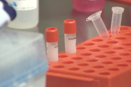 Pirmoji COVID-19 auka Lietuvoje yra garbaus amžiaus moteris, greičiausiai ji užsikrėtė ligoninėje.Pirmoji COVID-19 auka Lietuvoje yra garbaus amžiaus moteris, greičiausiai ji užsikrėtė ligoninėje.