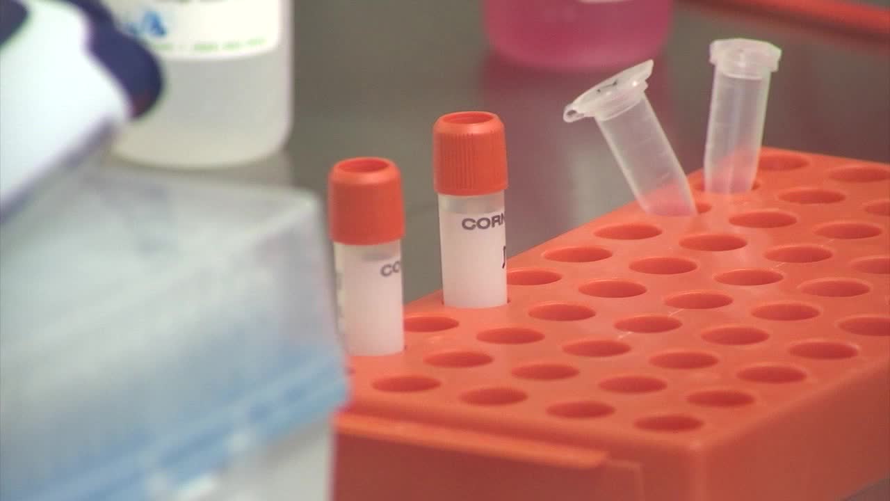 Pirmoji COVID-19 auka Lietuvoje yra garbaus amžiaus moteris, greičiausiai ji užsikrėtė ligoninėje.Pirmoji COVID-19 auka Lietuvoje yra garbaus amžiaus moteris, greičiausiai ji užsikrėtė ligoninėje.