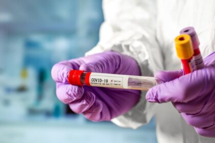 Lietuvoje per parą patvirtinti 24 nauji koronaviruso atvejai, bendras nustatytų atvejų skaičius išaugo iki 1350, antradienio rytą pranešė Sveikatos apsaugos ministerija.