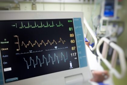 Lietuvoje ketvirtadienį mirė 31-as koronavirusu užsikrėtęs žmogus, pranešė Sveikatos apsaugos ministerija.