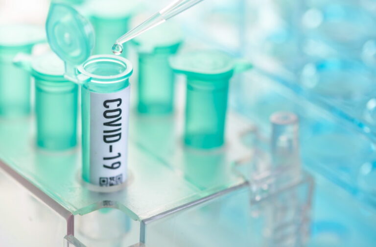 Lietuvoje per parą nustatyti 228 nauji koronaviruso atvejai.