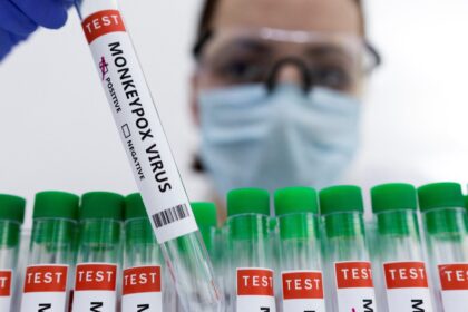 Šiuo metu Lietuvoje yra nustatyti trys epidemiologiškai tarpusavyje nesusiję beždžionių raupų atvejai, teigia Sveikatos apsaugos ministerijos (SAM) Sveikatos stiprinimo skyriaus vyriausioji specialistė Galina Zagrebnevienė.