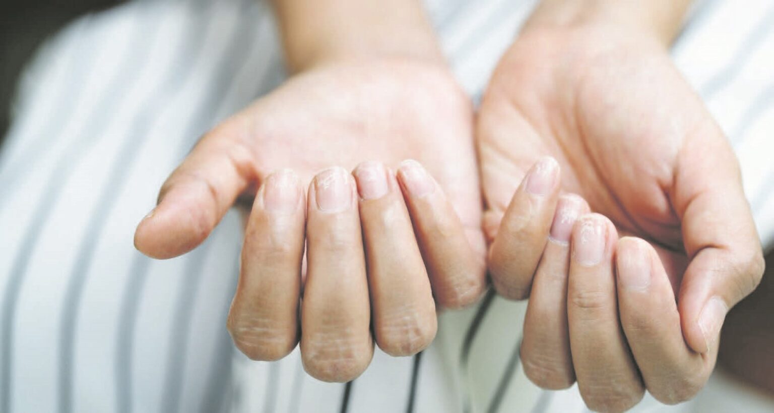 Visi žinome – nagai labai daug pasako apie mūsų sveikatą. Jeigu jie silpni, trapūs, nenatūralios spalvos ar rievėti, tai gali būti signalas, jog kažkas vyksta organizme.