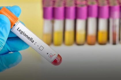 Lietuvoje per pirmąjį šių metų mėnesį iš viso užregistruoti penki legioneliozės atvejai, antradienį pranešė Nacionalinis visuomenės sveikatos centras (NVSC).