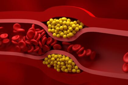 Išgirdus žodį „cholesterolis“, prieš akis iškyla užsikimšusios kraujagyslės, širdies priepuoliai ir gydytojai, griežtai perspėjantys: „Mažiau kiaušinių, daugiau salotų!“