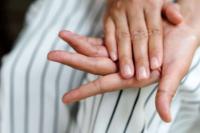 Nebūtinai visiems ir nebūtinai iškart pasirodantys subtilūs ženklai ant nagų gali tapti vienu pirmųjų įspėjimų, kad „blogojo“ cholesterolio kiekis organizme pasiekė pavojingą ribą.
