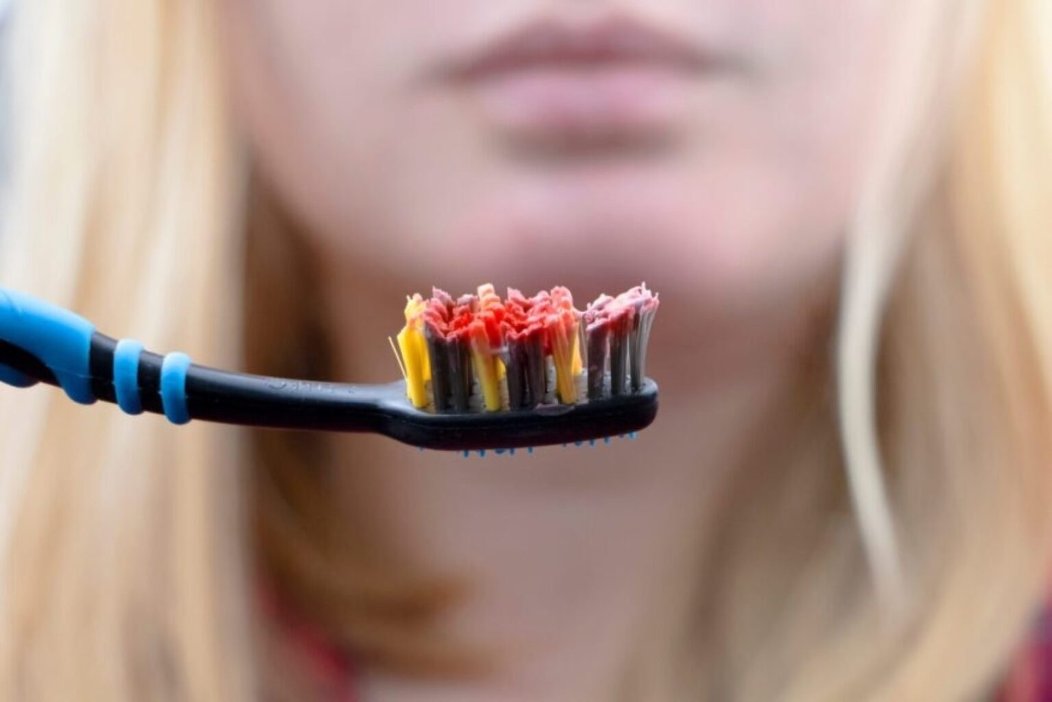 Yra daugybė priežasčių, dėl kurių gali kraujuoti ar skaudėti dantenos, pradedant nuo pernelyg didelio mūsų pačių entuziazmo valantis dantis ir tarpdančius.