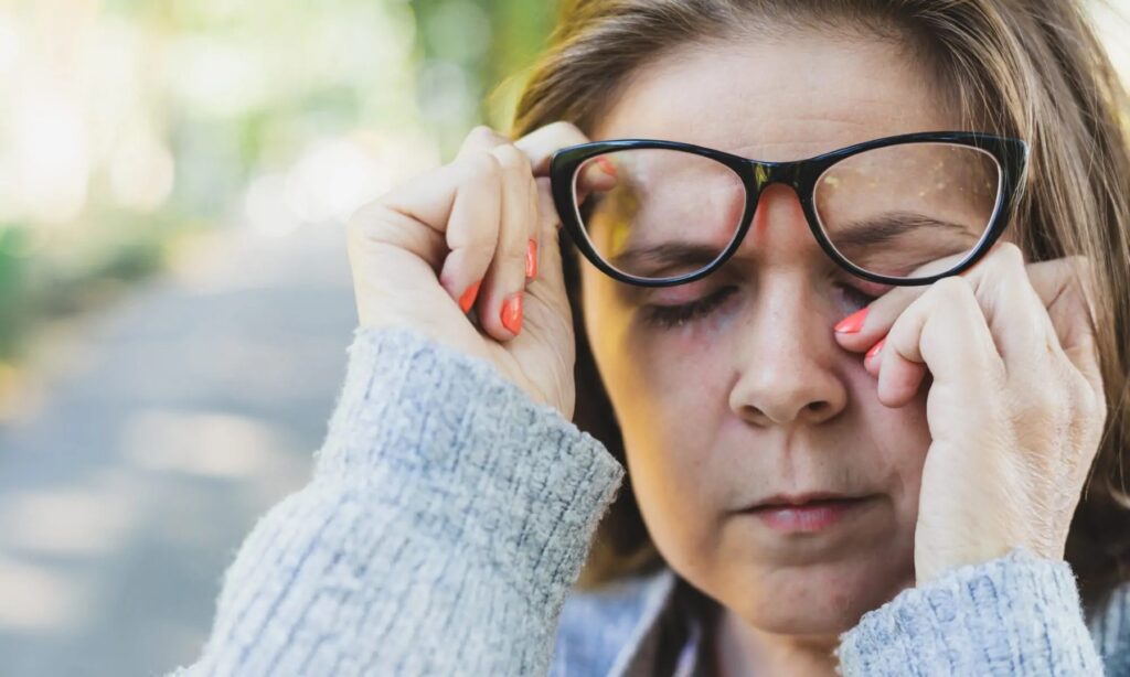 Kai išgirstame minint šią ligą, akių vokai paprastai nebūna ta vieta, kurią įsivaizduojame nuo jos nukenčiant.