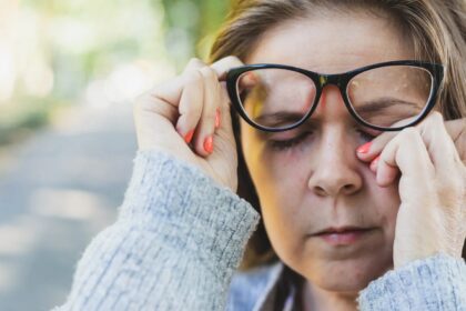 Kai išgirstame minint šią ligą, akių vokai paprastai nebūna ta vieta, kurią įsivaizduojame nuo jos nukenčiant.